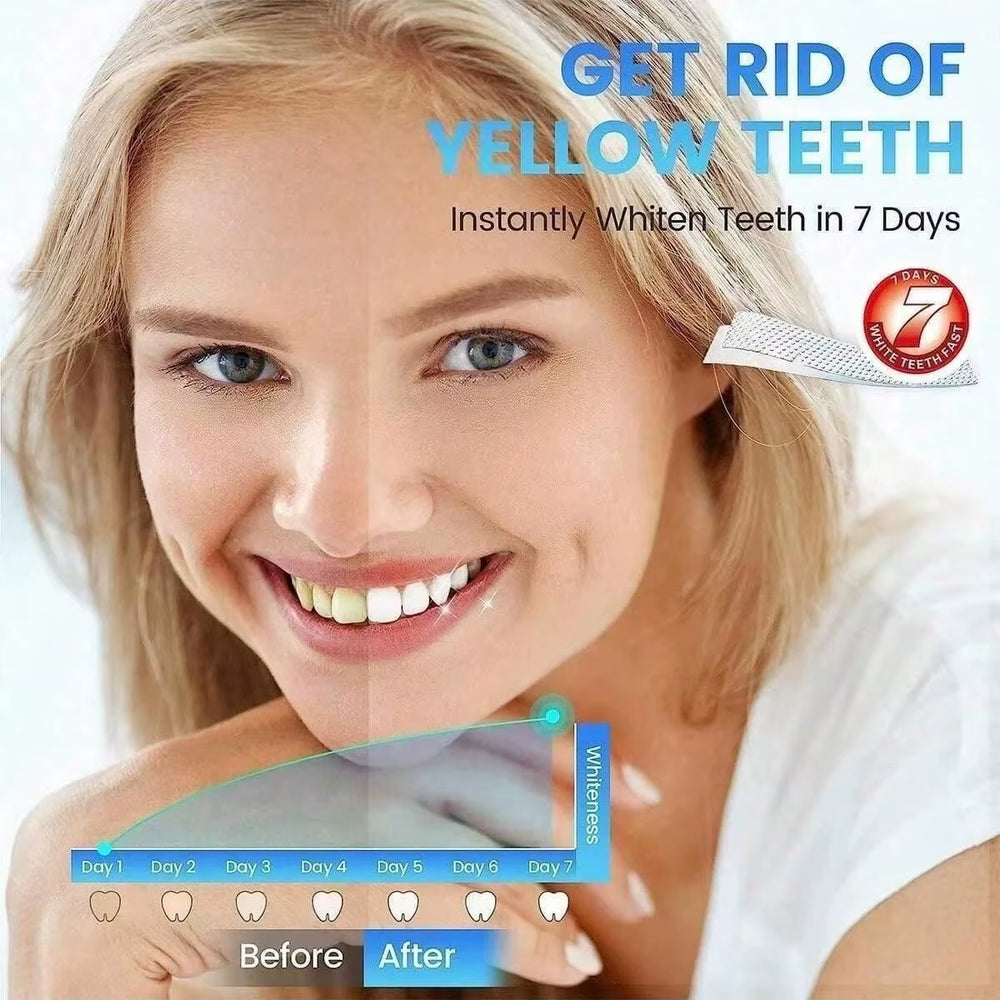 [5D] 28 Days Teeth Whitening Strips Whitener Strips Effective Teeth Whitener Helps Remove Smoking / Coffee / Soda / Wine Stain